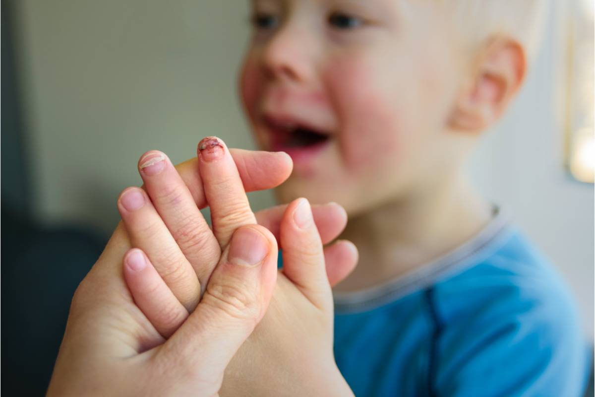 A Mom Says Her Son's School Nurse Sent Him Back to Class With a Broken Finger, Calling It "Probably Just a Sprain" Without an X-Ray or a Phone Call