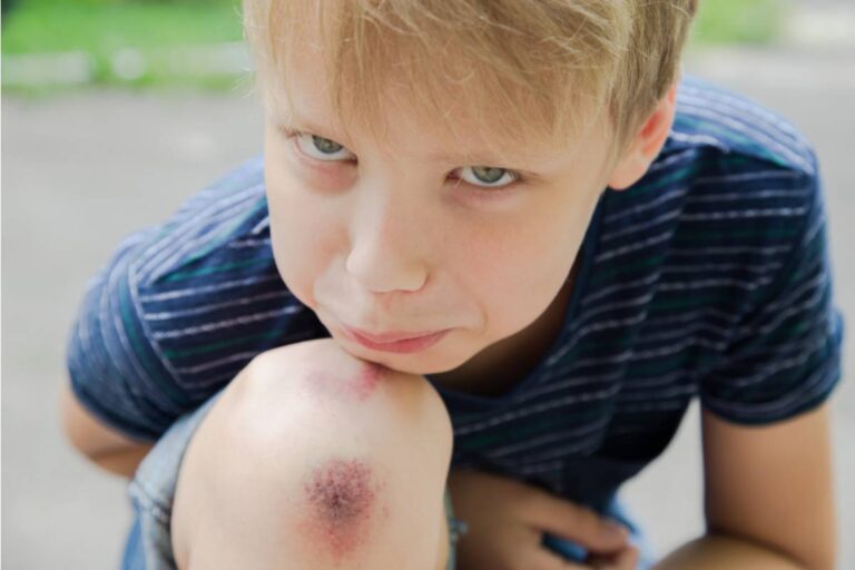 A Dad Found Out His Son Had Been Practicing What to Say if Anyone Ever Asked About the Bruises, Just in Case, Even Though There Weren't Any