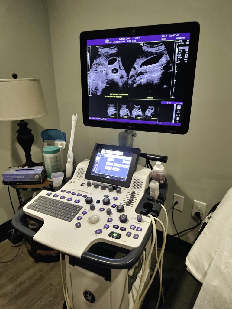 A medical ultrasound scanner in a hospital exam room